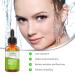 Buy Mabox Facial Serum with Vitamin B3 Niacinamide - Reduce Pore Size Tightens Skin Fights Acne & Fades Blemishes - Deep Hydration (1 Fl Oz) - International Shipping Available - Buy Online on SooperMarket.com