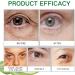 Aloe Vera Eye Cream Aloe Vera Under Eye Cream Eye Cream Anti Aging Eye Cream for Dark Circles and Puffy Eyes Eye Bags Remover Dark Eyes Circle Treatment Reduce Fine Lines Moisturising Soothing - Buy Online on SooperMarket.com