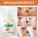 Turmeric Dark Spot Corrector Serum with Vitamin C - 30ml/1oz - Acne & Hyperpigmentation Treatment to Smooth Skin - Buy Online on SooperMarket.com