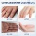 100 ml Aloe Vera Hand Cream - Gentle Hand Cream For Very Dry Hands Hand Moisturiser With Natural Aloe & Vitamin E Hands Gel For Sensitive Skin Aloe Vera Gel For Skin Care Hand Cream For Women - Buy Online on SooperMarket.com