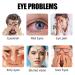 Eye Mask for Dry Eyes Dark Circles Relief - Ideal Gift for Women Men - 20 Units/Box - White - 1 Count - Buy Online on SooperMarket.com