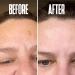 Dark Spot Corrector Serum - Remove Stubborn Dark Spots with Kojic Acid & Alpha Arbutin | Brightening Discoloration Remover for Face - Buy Online on SooperMarket.com