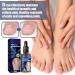 German Toenailcare Removal Paronychia Oil - Repair Damaged Discolored Thick Nails - 2 Pcs - Buy Online on SooperMarket.com