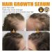 2023 New Allurium Hair Growth Serum for Black Women - Set of 3 Bottles | Anti Hair Loss, Nourishing & Repairing Formula for Fast, Natural Growth - Buy Online on SooperMarket.com