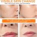 Turmeric And Vitamin C Face Serum Dark Spot Corrector Serum Turmeric Anti Aging Face Serum For Women Hydrating Serum Serum Face Oils Face Moisturizing Reduce Wrinkles Dark Spots For Body &Face - Buy Online on SooperMarket.com