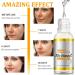 Shefave Vitamin C Serum for Face - Dark Spot Remover - Face Serum with 30x Vitamin C and Hyaluronic Acid - Anti-Dark Spot Serum - Fading Dark Spots for Tired Pale Skin - Buy Online on SooperMarket.com