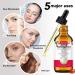 Organic Rosehip Oil (2.02 fl.oz) - 100% Pure Natural Cold Pressed for Face, Skin, & Hair Care - Anti Aging Moisturizer - Buy Online on SooperMarket.com