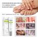 Yueci Hand and Foot Care Cream - Heal & Repair Damaged Nails | Nail Treatment for Cracked & Split Toes - Buy Online on SooperMarket.com