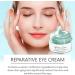 Toseky Eye Moisturizer Cream | Moisturizing Under Eye Cream For Radiant Skin | Advanced Hydration Dark Circles Under Eye Care Nourishing Eye Skin Care - Buy Online on SooperMarket.com