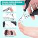 Jupeli Professional Toenail Clip Set - Sharp Stainless Steel Nail Clippers for Thick & Ingrown Nails 8PC Pedicure & Manicure Kit with Nail Scissors Shapers & Files - Perfect Foot Care Solution - Buy Online on SooperMarket.com