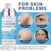 Buy Tranexamic Acid Serum - Discoloration Correcting Face Lotion | Natural Moisturizing Skincare | International Shipping - Buy Online on SooperMarket.com