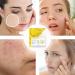 Toseky Face Moisturizing Patches Firming Face Sheet Masksss - Nourishing Skin Film Patch Moisturising & Hydrating Face Maskss Brightening For Woman Dry Skin Care - Buy Online on SooperMarket.com
