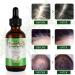 Rosemary Oil for Hair Growth & Skin Care - Stimulates Growth, Improves Scalp Health, 2.02 Fl Oz - Buy Online on SooperMarket.com