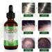 Rosemary Oil for Hair Growth & Loss Regrowth Treatment - 2.02 oz | Strengthens, Nourishes Scalp, Improves Circulation - Men & Women - Buy Online on SooperMarket.com