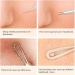 Blackhead Remover Tool Kit - FEITA Acne Pimple Tweezers Comedone Extractor Blemish Removal Tool Set for Facial Whitehead Popping Zit Removing - Buy Online on SooperMarket.com