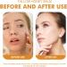 Tallow Honey Balm Tallow Moisturizer Firming Face Cream Tallow Face Cream Tallow Balm Instant Wrinkle Remover Tallow And Honey Balm Repair Barrier Face & Body Moisturiser For Dry Skin 30g - Buy Online on SooperMarket.com