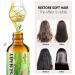 Rosemary Essential Oil for Hair Growth & Skin Care (2 Fl Oz) - Stimulates Growth, Nourishes Scalp, Improves Circulation - Hair Loss Treatment - Buy Online on SooperMarket.com