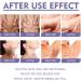 Dark Spot Corrector Stick Ordor Removal Moisturizing Armpit Whitening Cream with Centella Asiatica Extract for Elbows and Knees - Buy Online on SooperMarket.com