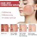 Trendyfave Dark Spot Serum Niacinamide Serum Brightening Serum 10% Niacinamide+ 4% Tranexamic Acid Dark Spot Corrector For Face Age Spot Remover For Face Face Redness Remover Arbutin Serum - Buy Online on SooperMarket.com
