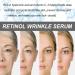 Japan Retinol Serum - 0.4% Retinol & Hyaluronic Acid | Anti-Aging Face Serum for Women & Men | Reduce Fine Lines & Wrinkles - Buy Online on SooperMarket.com