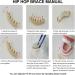 Gold Teeth Brace Set Hip Hop Punk Custom Fit Metal Teeth Decoration Jewelry Gold Teeth Grillz Oral Pain ReliefOral Care() - Buy Online on SooperMarket.com