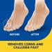 Dr. Scholl's Liquid Corn & Callus Remover - Buy Online on SooperMarket.com