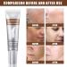 Dark Spot Remover Hyperpigmentation Treatment Dark Spot Corrector for Face Freckle Remover Cream Age Spots & Sunspots & Melasma Cream Even Skin Tone Moisturizing Erase Fine Lines Firming - Buy Online on SooperMarket.com