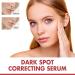 Tongyend Dark Spot Serum Brightening Serum Niacinamide Serum Faded Cream For Dark Spots Dark Spot Corrector For Face Age Spot Remover For Face Face Redness Remover Arbutin Serum Acne Scar 30ml - Buy Online on SooperMarket.com