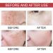 Trendyfave Dark Spot Serum Niacinamide Serum Brightening Serum 10% Niacinamide+ 4% Tranexamic Acid Dark Spot Corrector For Face Age Spot Remover For Face Face Redness Remover Arbutin Serum - Buy Online on SooperMarket.com