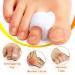 Anggrek Gel Toe Separators - 6 Pairs Silicone Relief Bunion Pain Corrector for All Shoes - Blue/White - Buy Online on SooperMarket.com