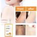 FAYNDE Turricum Body Cream 100ml - Nourishing Daily Skin Care with Ginger Extract for Women & Teens | Ideal for Back Neck Shoulders Arms & Legs - Buy Online on SooperMarket.com