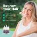 Minoxidil 2% Women's Hair Growth Serum | Promotes Hair Regrowth | Reactivates Hair Follicles | Shapiro MD - Buy Online on SooperMarket.com