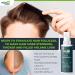 HairMD Transplant Clinical Repair Serum - 60ml Hair Regrowth Serum | Prevents Hair Loss, Stimulates New Growth | Fast & Effective Formula - Buy Online on SooperMarket.com