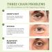 Retinol Eye Cream - Brightening Anti-Aging Eye Stick for Dark Circles & Puffiness | Under Eye Treatment for Men & Women - Buy Online on SooperMarket.com