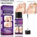 Fungal Nail Treatment 30ml Extra Strong Nail Fungus Treatment for Toenail and Fingernail Premium Fungal Nail Eliminator Anti fungus Nail Repair and Strengthen Fix & Renew Damaged Broken Nails - Buy Online on SooperMarket.com