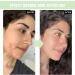 Panthenol Face Serum Niacinamide Serum Brightening Serum Hydrating Serum Korean Serum For Repair Dark Spot Corrector For Face Calming Serum Green Tea+Hyaluronic Acid Panthenol Cream - Buy Online on SooperMarket.com