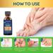 Extra Strength Toe Nail Fungus Treatment for Healthy Nails - Fingernail and Toenail Repair Solution - Buy Online on SooperMarket.com