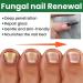 MrCuvaryas Nail Serum for Toenails Extra Strong - Buy Online on SooperMarket.com