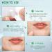 AUSLKA Blemish Patch Hydrocolloid Blemishes Patch Dots for Face Zit Patches Zit Stickers (9 Patches) 9 count (Pack of 1) - Buy Online on SooperMarket.com