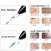 CHRERNA Skin Tags & Mole Removal Kit - 9 Modes Plasma Pen for Warts, Spots, Body & Facial Nevus - Buy Online on SooperMarket.com