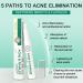 Anti-Acne Face Cream Spot Cream for Acne Treatment and Spot Treatment Skin Treatment Gel Cream For Face Blemishes & Blackheads Acne Treatment Cream Anti Acne Spot - Buy Online on SooperMarket.com
