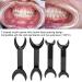 4-Piece Dental Cheek Holder Set | T-Shape Intraoral Lip Openers for Tooth Whitening | Mouth Opener & Tooth Holder - Buy Online on SooperMarket.com