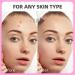 EFLY Hydrocolloid Pimple Patches with Tea Tree Oil & Salicylic Acid Invisible Acne Dots for Face 210 Patches - Buy Online on SooperMarket.com