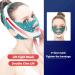 V-Line Face Lift Band - Facial Slimming & Lifting Strap for Men & Women | Anti-Sagging Chin Support for Defined Jawline & Wrinkle Reduction (Coffee - Buy Online on SooperMarket.com