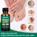 XIFEPFR Toenail Repair Treatment - Extra Strength Nail Renewal Solution for Thick, Brittle, and Discolored Nails - Buy Online on SooperMarket.com
