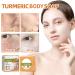 Nmbol Skin Turmeric Soap Cojic Acid Soap For Skin Lightening Kurkuma Soap Lightening Solid Facial Soap Handmade Organic Natural Soap Soap For Dark Spots Hyperpigmentation Smooth Skin - Buy Online on SooperMarket.com