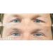 Slue Pflid Tape - Eye Lifting Adhesive Strips | Waterproof 24-Hour Hold | Tast Package S M L - Buy Online on SooperMarket.com