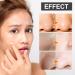 Peel Off Blackhead Removal Mask - Acne Treatment Pore Cleansing Cream & Nose Strips - 30ml + 60 Pcs for Clear Skin - Buy Online on SooperMarket.com