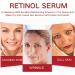 Retinol Serum For Face - Retinol Face Serum For Anti Wrinkle Dark Spot Serum For Brightening And Rejuvenating Skin - Hyaluronic Acid Serum With Retinol & Hydrolyzed Collagen - Buy Online on SooperMarket.com