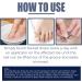 Ingrown Toenail Treatment Correction Drops Nail Growth Treatment Nail Care Ingrowing Toenail Treatment Ingrown Toenail Corrector Treatment for Ingrown Toenail Ingrowing Toenail Improve Toenail Health - Buy Online on SooperMarket.com